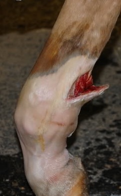 PD Laceration